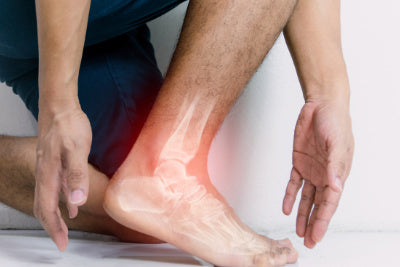 Ankle Arthritis